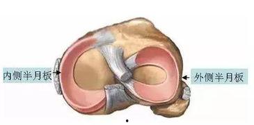 明星半月板损伤,揭秘运动损伤背后的真相